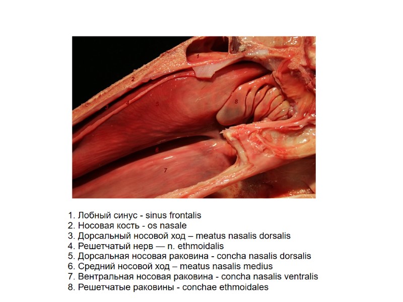 1. Лобный синус - sinus frontalis 2. Носовая кость - os nasale 3. 1. Лобный синус - sinus frontalis 2. Носовая кость - os nasale 3.